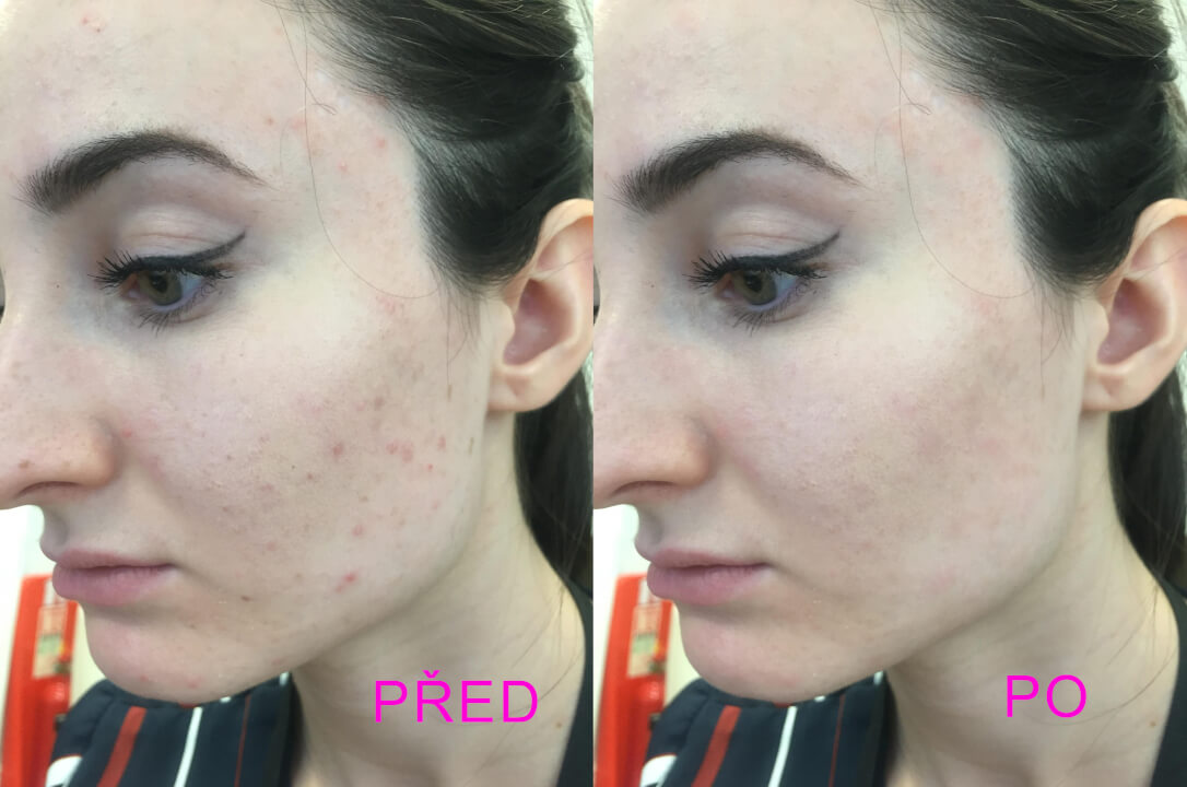 Plakát, banner, diplom, retuš