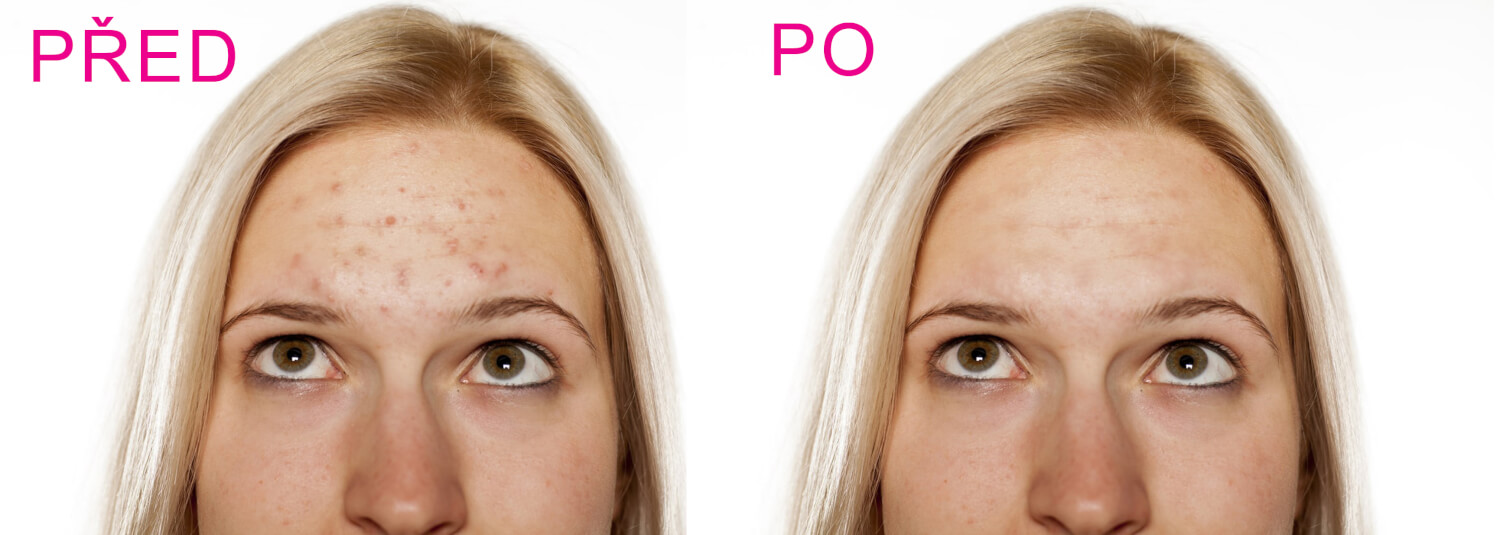 Plakát, banner, diplom, retuš