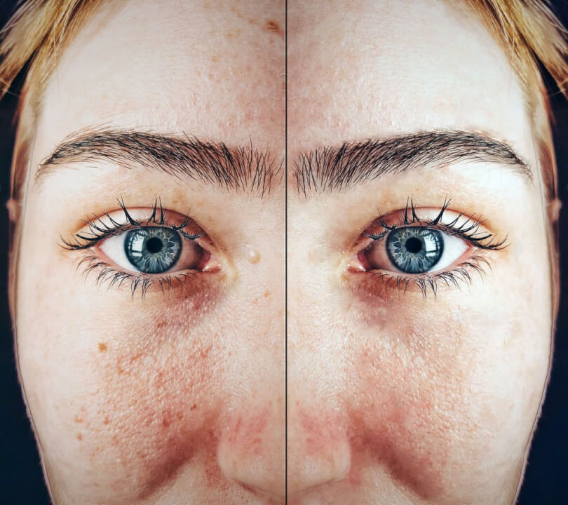 Fotomontáže, úprava fotek, retuš a mnoho dalšího