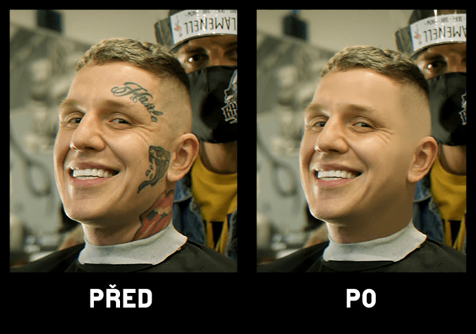 Vyhlazení nedokonalostí obličeje / těla včetně tetování
